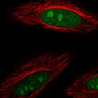 Immunofluorescent staining of human cell line HeLa shows localization to nucleus & nucleoli.