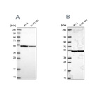Western blot analysis using Anti-IPO4 antibody HPA039043 (A) shows similar pattern to independent antibody HPA064572 (B).