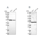 Western blot analysis using Anti-IPO4 antibody HPA039043 (A) shows similar pattern to independent antibody HPA064572 (B).
