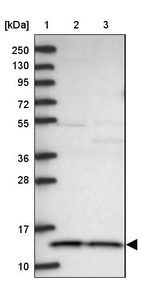 Lane 1: Marker [kDa] 250, 130, 95, 72, 55, 36, 28, 17, 10_br/_Lane 2: Human cell line RT-4_br/_Lane 3: Human cell line U-251MG sp