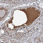 Anti-C14orf80 Antibody