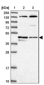 Lane 1: Marker [kDa] 250, 130, 95, 72, 55, 36, 28, 17, 10_br/_Lane 2: Human cell line RT-4_br/_Lane 3: Human cell line U-251MG sp