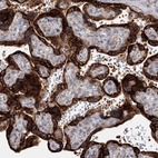 Anti-SPG20 Antibody