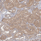 Anti-SPG20 Antibody