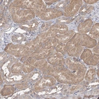 Anti-SPG20 Antibody