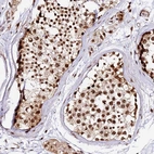 Anti-MCRS1 Antibody