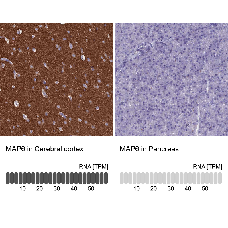 Anti-MAP6 Antibody
