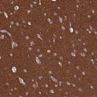 Immunohistochemical staining of human cerebral cortex shows strong positivity in neuronal processes in neuropil.