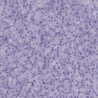 Anti-MAP6 Antibody