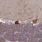 Anti-MAP6 Antibody