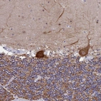 Immunohistochemical staining of human cerebellum shows strong cytoplasmic positivity in Purkinje cells.