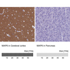 Anti-MAP6 Antibody