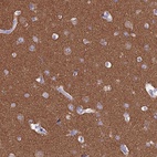 Immunohistochemical staining of human cerebral cortex shows high expression.
