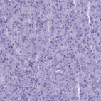 Anti-MAP6 Antibody