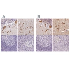 Immunohistochemical staining of human cerebellum, cerebral cortex, lymph node and pancreas using Anti-MAP1A antibody HPA039064 (A) shows similar protein distribution across tissues to independent antibody HPA039063 (B).