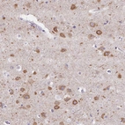 Immunohistochemical staining of human cerebral cortex shows high expression.