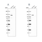 Western blot analysis using Anti-MAP6 antibody HPA039062 (A) shows similar pattern to independent antibody HPA039061 (B).