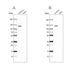 Western blot analysis using Anti-MAP6 antibody HPA039062 (A) shows similar pattern to independent antibody HPA039061 (B).