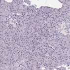 Immunohistochemical staining of human pancreas shows low expression as expected.