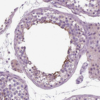Immunohistochemical staining of human testis shows weak to moderate positivity in cilia in spermatids.