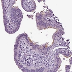 Immunohistochemical staining of human fallopian tube shows weak to moderate positivity in cilia in glandular cells.