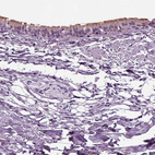 Immunohistochemical staining of human bronchus shows weak to moderate positivity in cilia in respiratory epithelial cells.