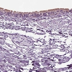 Immunohistochemical staining of human bronchus shows weak to moderate positivity in cilia in respiratory epithelial cells.