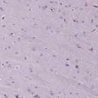 Immunohistochemical staining of human cerebral cortex shows no positivity in neurons as expected.