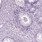 Immunohistochemical staining of human prostate shows no positivity in glandular cells.