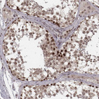 Anti-HMGA2 Antibody