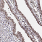 Immunohistochemical staining of human fallopian tube shows moderate nuclear positivity in glandular cells.