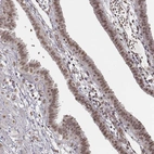 Immunohistochemical staining of human fallopian tube shows moderate nuclear positivity in glandular cells.