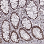 Immunohistochemical staining of human rectum shows moderate nuclear positivity in glandular cells.