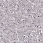 Immunohistochemical staining of human liver shows no positivity in hepatocytes as expected.