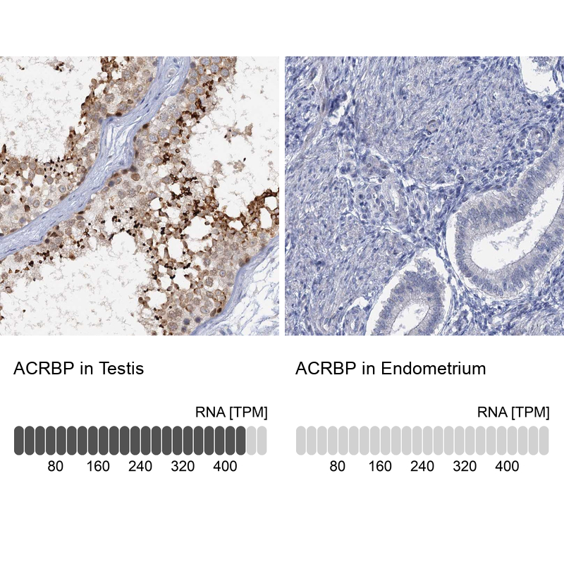 Anti-ACRBP Antibody