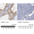 Anti-ACRBP Antibody