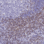Anti-CD7 Antibody