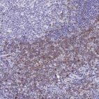 Immunohistochemical staining of human tonsil shows strong membranous and cytoplasmic positivity in non-germinal center cells.