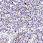 Anti-CD7 Antibody