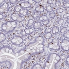 Immunohistochemical staining of human small intestine shows strong membranous and cytoplasmic positivity in lymphoid cells.
