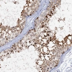 Immunohistochemical staining of human testis shows high expression.