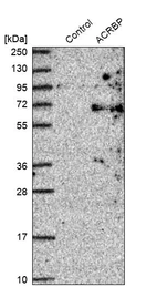 Western blot analysis in control (vector only transfected HEK293T lysate) and ACRBP over-expression lysate (Co-expressed with a C-terminal myc-DDK tag (~3.1 kDa) in mammalian HEK293T cells, LY403164).