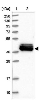 Lane 1: Marker [kDa] 250, 130, 95, 72, 55, 36, 28, 17, 10_br/_Lane 2: Human cell line RT-4