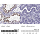 Anti-ACRBP Antibody