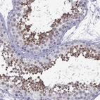 Immunohistochemical staining of human testis shows high expression.