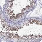 Immunohistochemical staining of human testis shows high expression.