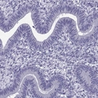 Immunohistochemical staining of human endometrium shows low expression as expected.