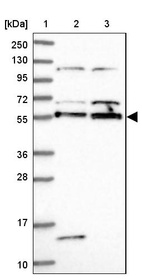 Lane 1: Marker [kDa] 250, 130, 95, 72, 55, 36, 28, 17, 10_br/_Lane 2: Human cell line RT-4_br/_Lane 3: Human cell line U-251MG sp