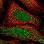 Immunofluorescent staining of human cell line U-2 OS shows localization to nucleoplasm & vesicles.