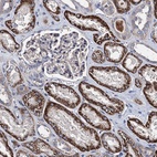 Anti-AKAP11 Antibody